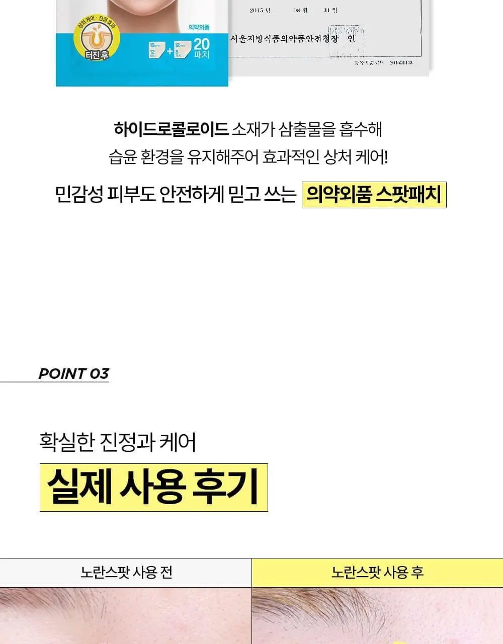 [올영단독기획 / 짜기 전/후 구성] 해서린 스팟케어 패치 키트 대용량 기획 140매 상세페이지 29